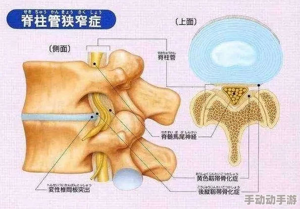融化c1v1骨科：探讨C1和C2椎骨的解剖结构及其在脊柱手术中的重要性与技术进展