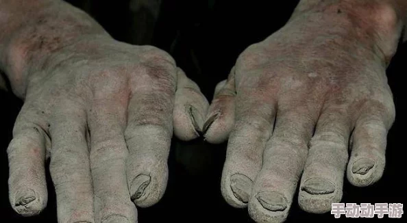 男人割了皮包什么样子要手举着呢？震惊！真实手术过程曝光，伤口竟然如此惊人，不可思议！