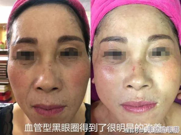 解锁燃脂变美新境界：眼神好也能助力，全面通关攻略分享