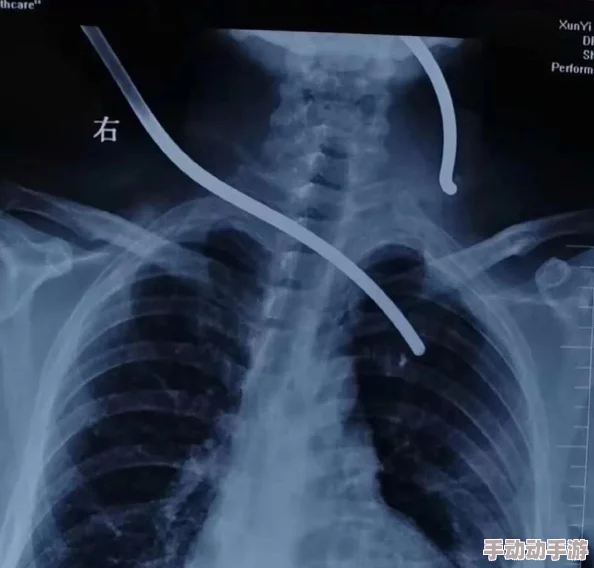 小孩半夜喂姐姐吃钢筋，家长惊呼不已，专家提醒儿童安全教育刻不容缓！