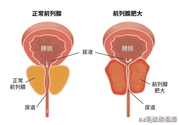 男人丿j硬起真实图片：最新动态揭示男性健康与生活方式的密切关系，引发广泛关注与讨论