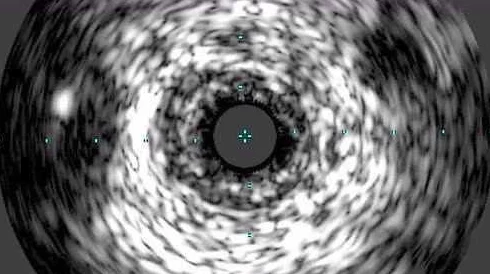 X7x7x7x7x7任意噪10是不是没用了？科学家最新研究揭示惊人真相！