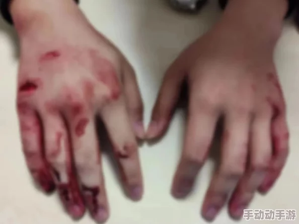 双手绑在床头乳尖网友认为这种行为可能涉及不当内容，呼吁加强对网络信息的监管与引导，以保护青少年心理健康