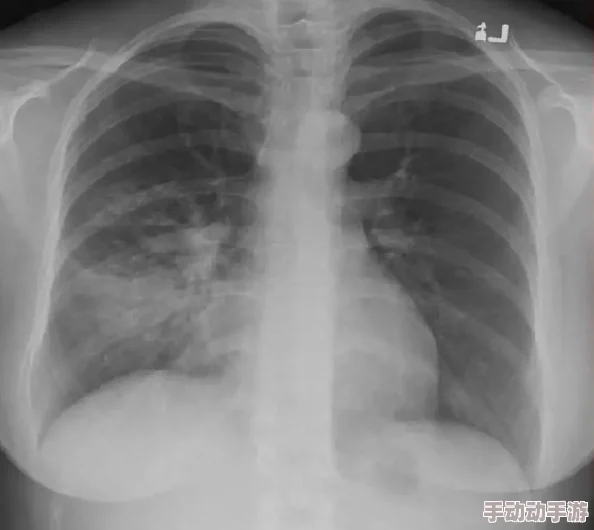 亲胸揉胸膜下刺激视频高最新进展显示该技术在医学研究中取得突破性进展,相关应用前景广阔引发广泛关注 亲胸揉胸膜下刺激视频高最新进展显示该技术在医学研究中取得突破性进展,相关应用前景广阔引发广泛关注