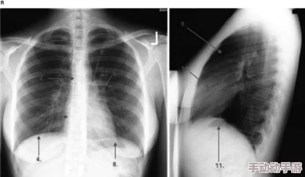 亲胸揉胸膜下刺激视频高最新进展显示该技术在医学研究中取得突破性进展,相关应用前景广阔引发广泛关注 亲胸揉胸膜下刺激视频高最新进展显示该技术在医学研究中取得突破性进展,相关应用前景广阔引发广泛关注
