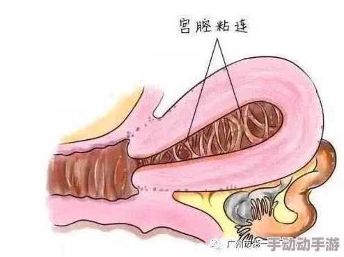 三洞齐插好深到子宫了最新研究显示该技术在医疗领域的应用潜力引发广泛关注与讨论