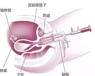 老女人擦她毛茸茸的阴户这句描述可能带有某种隐喻或象征意义，表达了对自然衰老过程的接受和坦然面对生理变化的心态